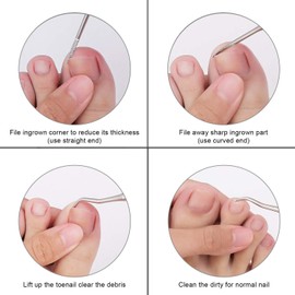 Double Sided Nail File Lifter for Ingrown Hair Edges Foot Care
