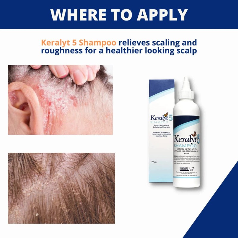 Keralyt 2 Pack! Karalyt 5 Shampoo, Exfoliating Shampoo for Dry,