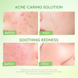 crema facial oil free para piel grasa, para piel propensa a imperfecciones con 3D Complex y Kiwi Extract, hidratación ligera y apoyo para la aparienci