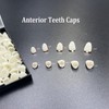 1 Box False Teeth Crown Repair Kit Dental Anterior Veneers