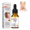Wm Suero Serum Facial Anti Aging Para Reducir Lineas De