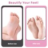 AprElm 4.8IN Longer Electric Foot Callus Remover with 80pcs Sandpaper