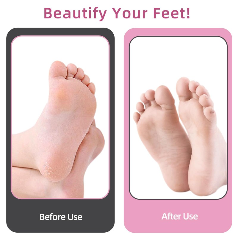 AprElm 4.8IN Longer Electric Foot Callus Remover with 80pcs Sandpaper