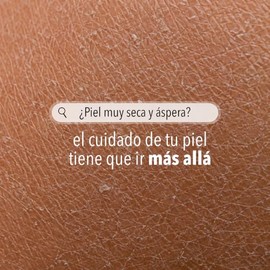 Derman DB Calm Crema Corporal │ Urea-D 10% + Ácido Hialurónico │ 300 g
