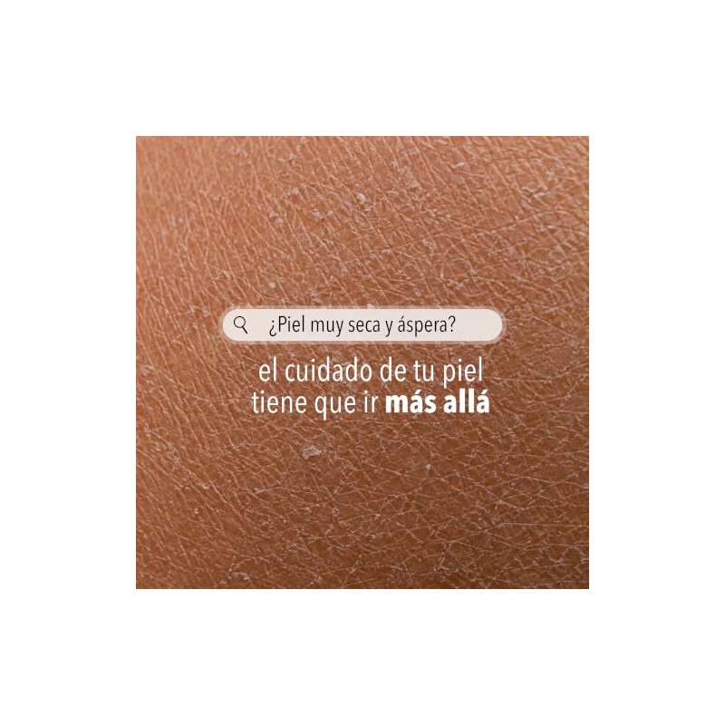 Derman DB Calm Crema Corporal │ Urea-D 10% + Ácido