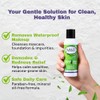 Demodex Control - Specifically Formulated Makeup Remover for Demodex Prone