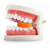 KISEER 24 Pcs Colorful Orthodontic Aligner Chewies for Aligner Chompers