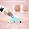 Blackhead Remover Pore Vacuum Kit - 2023 Upgraded Blackhead Extractor