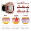 Aqua Aesthetics Mini Hifu Portatil Radiofrecuencia Ultrasonido Rf Facial V2