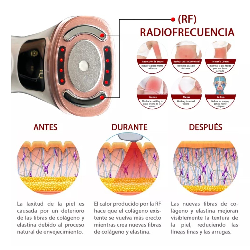 Aqua Aesthetics Mini Hifu Portatil Radiofrecuencia Ultrasonido Rf Facial V2