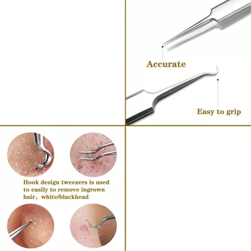 Margalla Int® Sharp Tweezers Blackhead Pimple Popper Remover Professional Skin