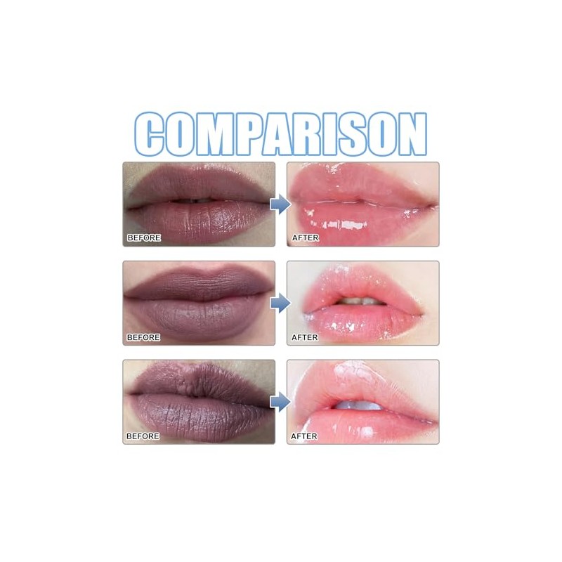 XIRUJNFD Sérum Labial, Elimina Labios Oscuros, Aclara Labios Rosados, Bálsamo