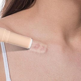 Barra de silicona para cicatrices - Barra de silicona para cicatrices al 60% - 5.7 g/0.2 fl oz - Suaviza, alisa y reduce la apariencia de las cicatrices - Para rostro y cuerpo (0.2 fl oz (Pac