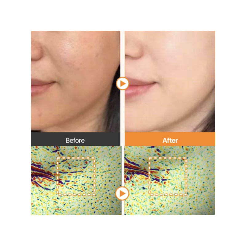 SUNGBOON EDITOR Gold Tomato Antioxidant First Bubble Serum 150ml