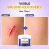 PURESKIN Manuka Honey Wound Care: Manuka Honey Ointment for Wounds,