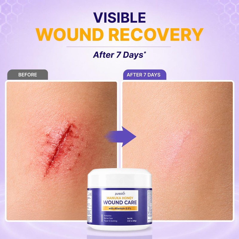 PURESKIN Manuka Honey Wound Care: Manuka Honey Ointment for Wounds,