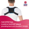Clavicle after the fracture of the clavicle back straightener, back