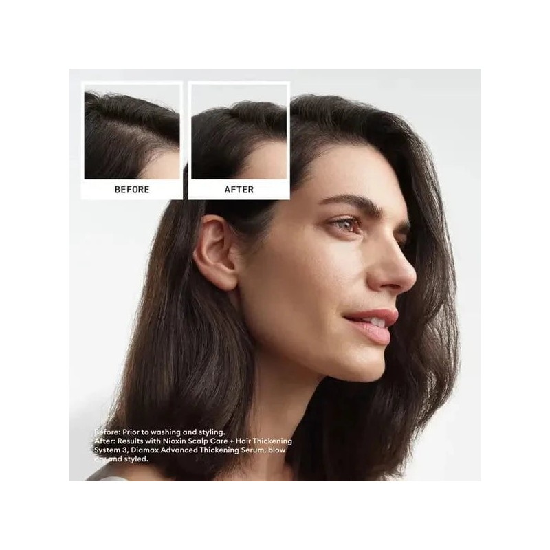 Nioxin Scalp + Hair Thickening System 3 Full Size Kit