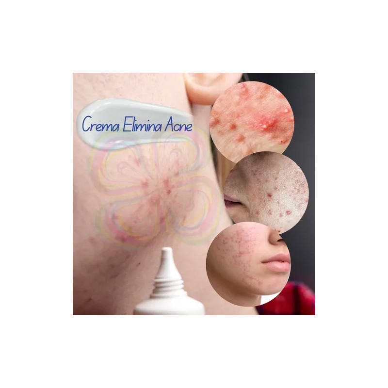 Crema Cicatrices Poros Control De Grasa Acne Cream 2pz Full