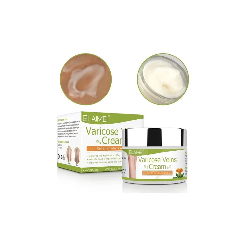 Crema Varices Mejor Apariencia De Tus Piernas Alivia Dolor