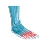 SoleM8 Full Length Orthotic Insole with Metatarsal Dome (7.5-7)