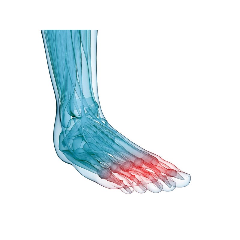 SoleM8 Full Length Orthotic Insole with Metatarsal Dome (7.5-7)