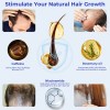 Serum Para El Crecimiento Del Cabello Eoiroa Con 3% De