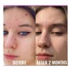 Zlu Srum De Niacinamida Good Molecules - 30 Ml Piel