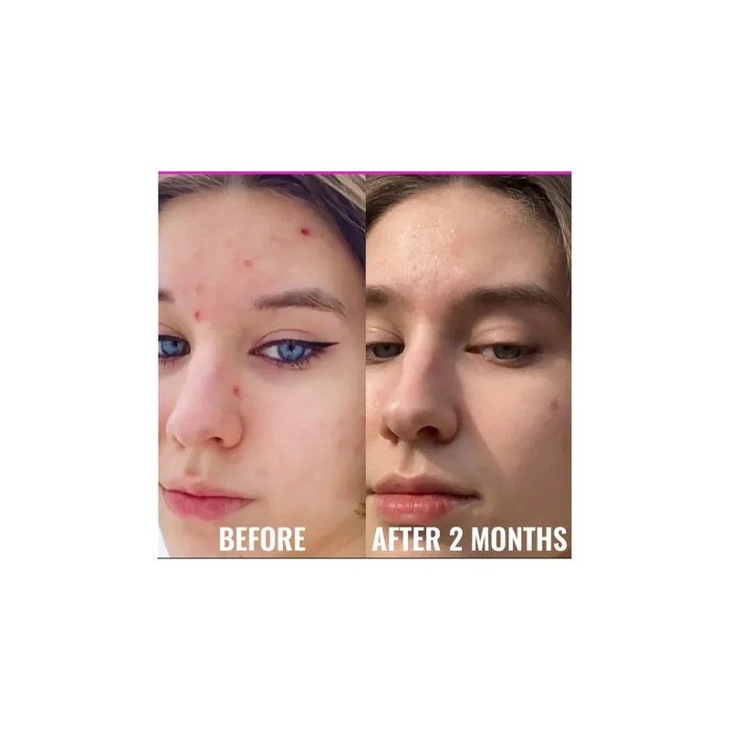 Zlu Srum De Niacinamida Good Molecules - 30 Ml Piel