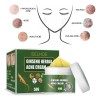 Crema De Tratamiento De Acné Con Ginseng Para Eliminar Las
