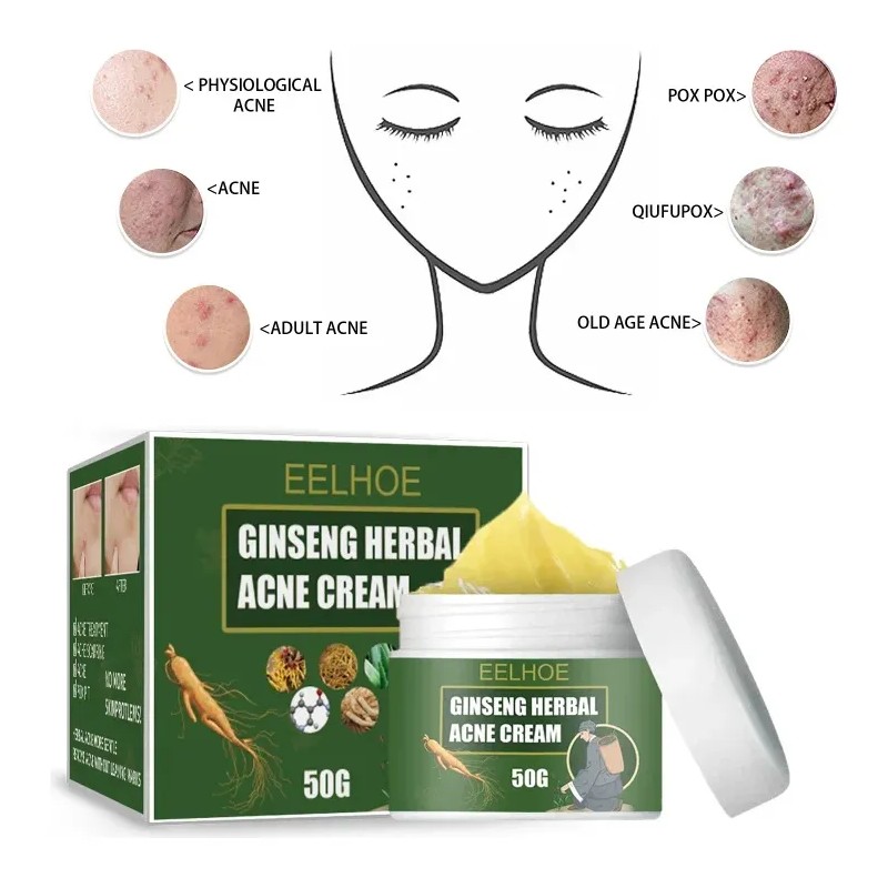 Crema De Tratamiento De Acné Con Ginseng Para Eliminar Las