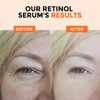 Retinol Serum for Face 2.5%, B5 Resurfacing Retinol Serum with