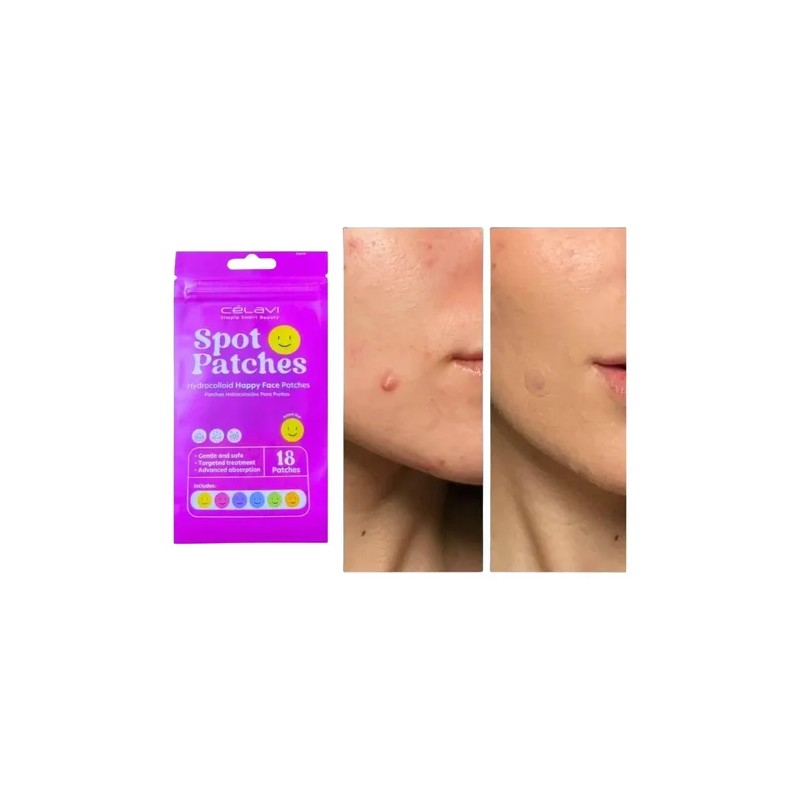 Paq 36 Spot Patches Parche Acne Caritas Dia Y Noche