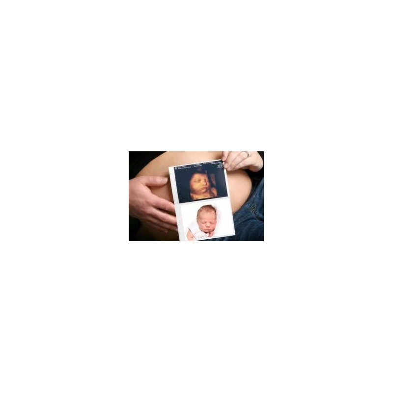 Sony SONY THERMAL PRINT PACK LARGE UPC-21L