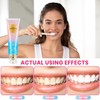 2Pcs Niacinamide Whitening Toothpaste Radiant Whitening Toothpaste, Niacinamide Intensive White