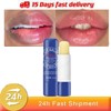 Sale!! Remove Dark Lip Balm Lighten Melanin Keeping Elasticlip Mask