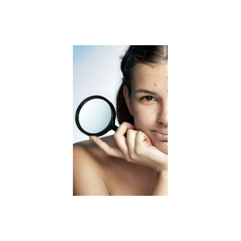 Prontomed Skin Balance Akut, 8 ml, Innovative Active Gel Against