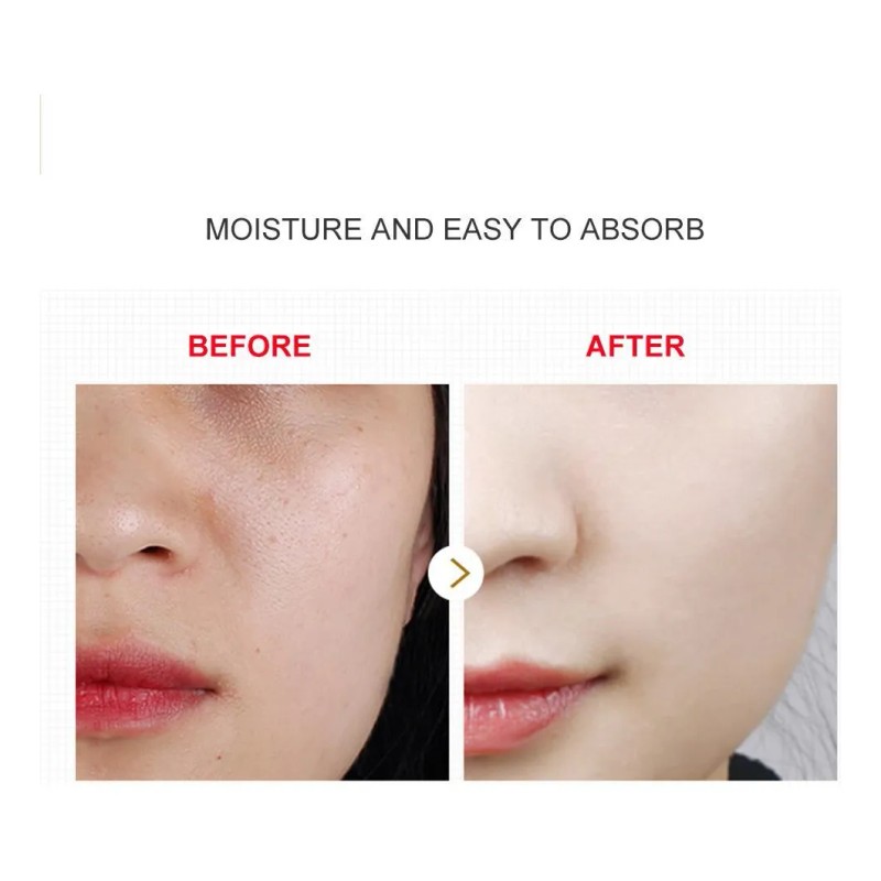Cápsulas De Suero Hialurónico, Hidratante Facial, Cápsula Fa