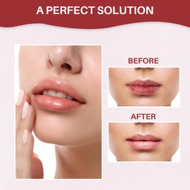 Cosmetofood Bioglam Smoky Lips Watermelon Lush Lip Lightening & Plumping Serum Roll-On For Soft & Plump Lips, 10ml