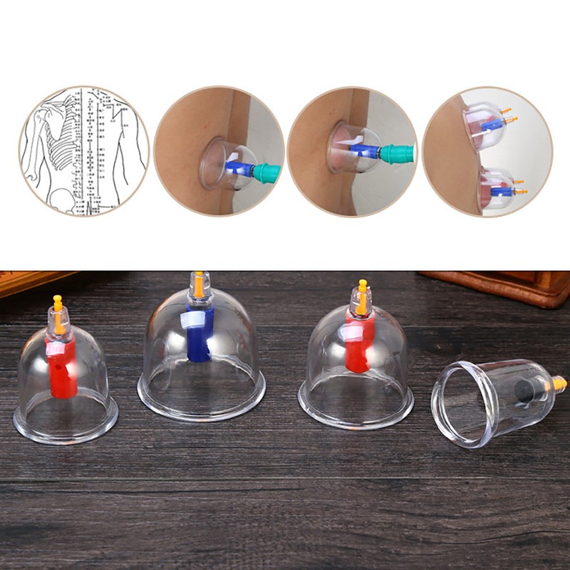 24pcs U shape Cups Chinese Vacuum Cupping Set Massage Therapy