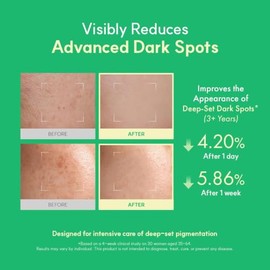 Easydew DW-EGF Melatoning Ampolla 5X - Suero Hidratante para Manchas Oscuras con Niacinamida y Glutatión para Piel Desigual - Ampolla de Absorción Ráp