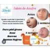 Olvídate Acné Ten Cutis Más Limpio
