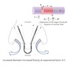 Silent Mammoth Reusable Adjustable Nasal Dilator (Large) Opens Nose to