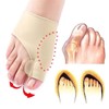 Bunion Corrector Splint Gel Bunion Pads Sleeves Brace – Toe