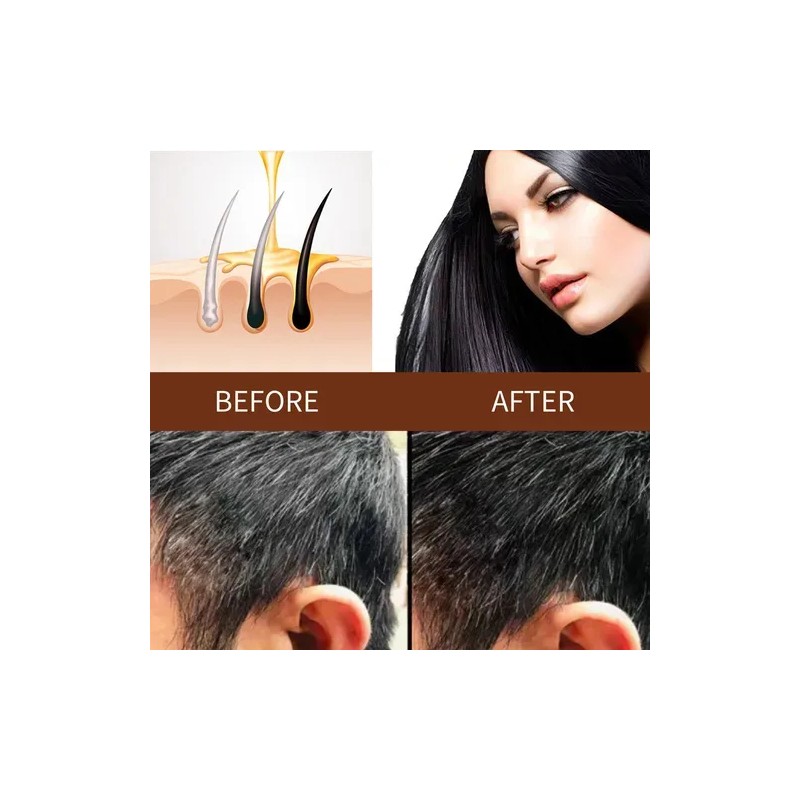 Mz . Jabón Para El Cuidado Del Cabello Con Polygonum