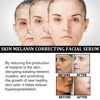 Melanin Correcting Facial Serum, Dark Spot Corrector Daily Face Serum,