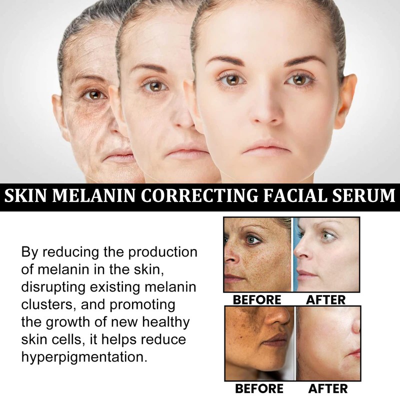 Melanin Correcting Facial Serum, Dark Spot Corrector Daily Face Serum,