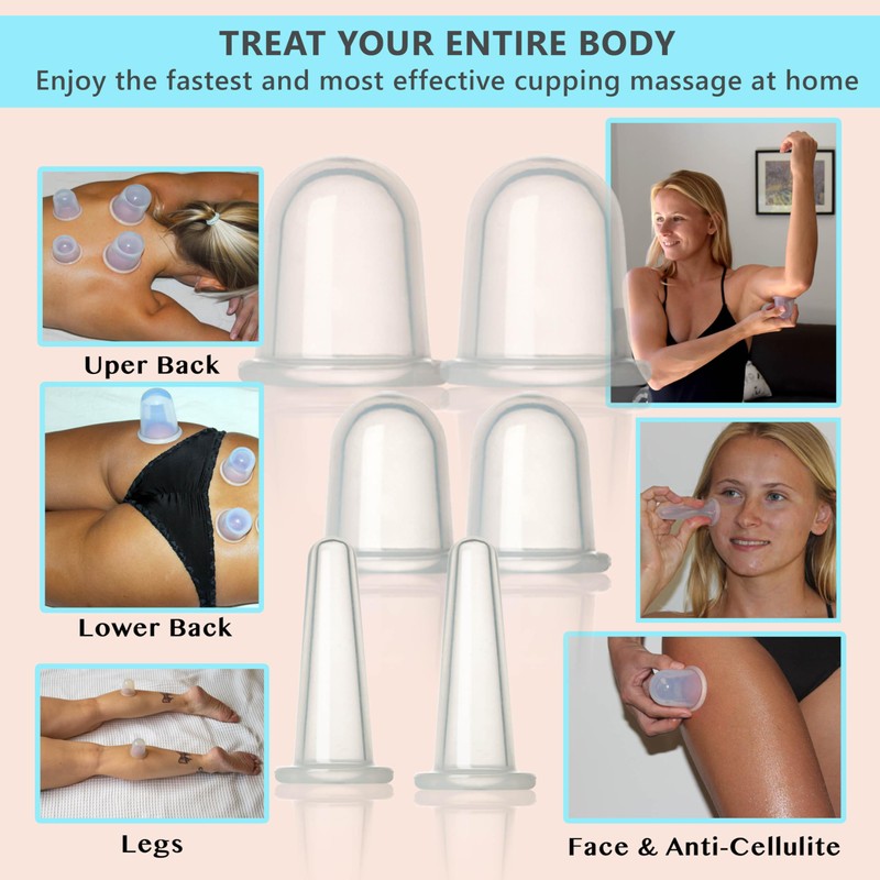 Cupping Kit for Massage Therapy - by DoSensePro, Cupping Set