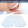 Dental Guide Plate Clear Accurate Measurement Dental Teeth Arrangement Guide