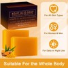 2PCS Turmeric Soap Bar, Kojic Acid Soap, Natural Handmade Bar